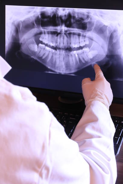 Best Dentist for Tooth Abscess  in Ninety Six, SC